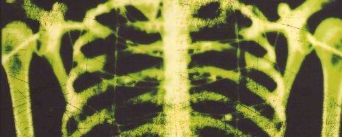 The Body Farm